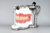 熱可塑性樹脂義歯